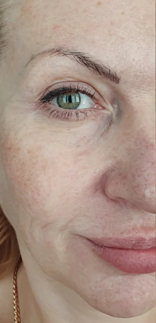 rosental organics ems gua sha before and after comparison