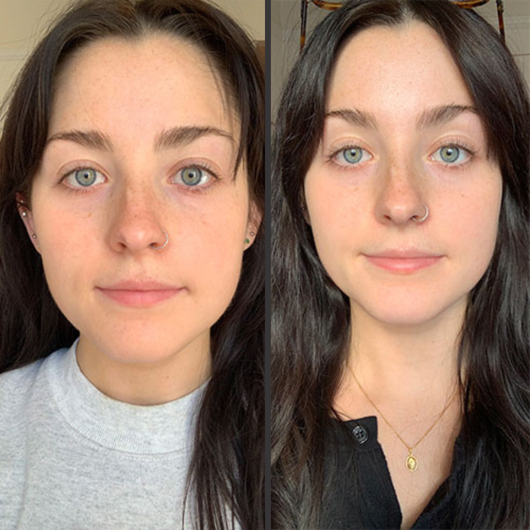 facial change after ems gua sha reatment