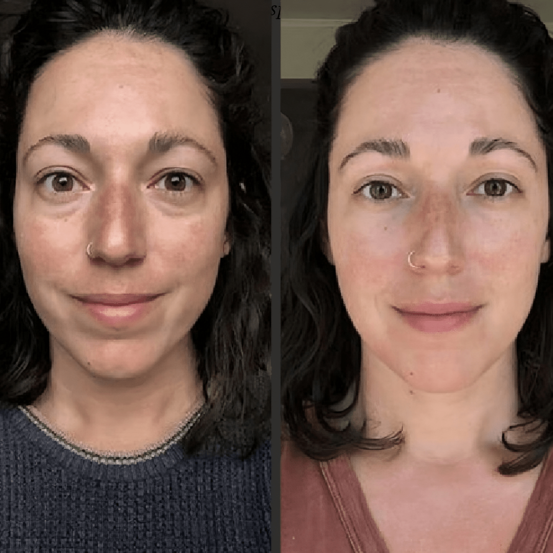 Rosental organics before and after effect on womans face after gua sha therapy