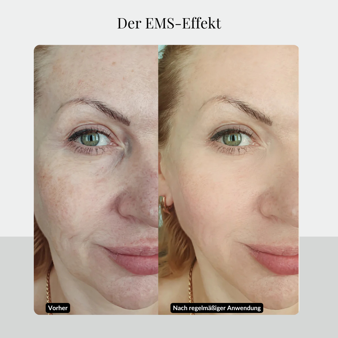 Rosental organics before and after gua sha therapie